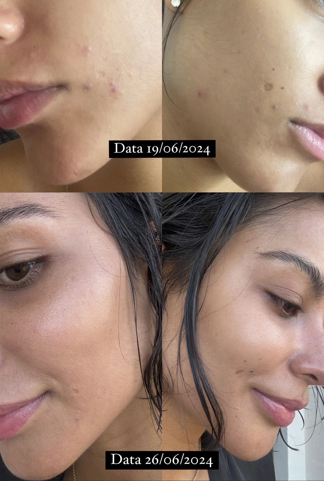 prova social glowup 6